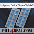 Imágenes De La Píldora Tadalafil 23